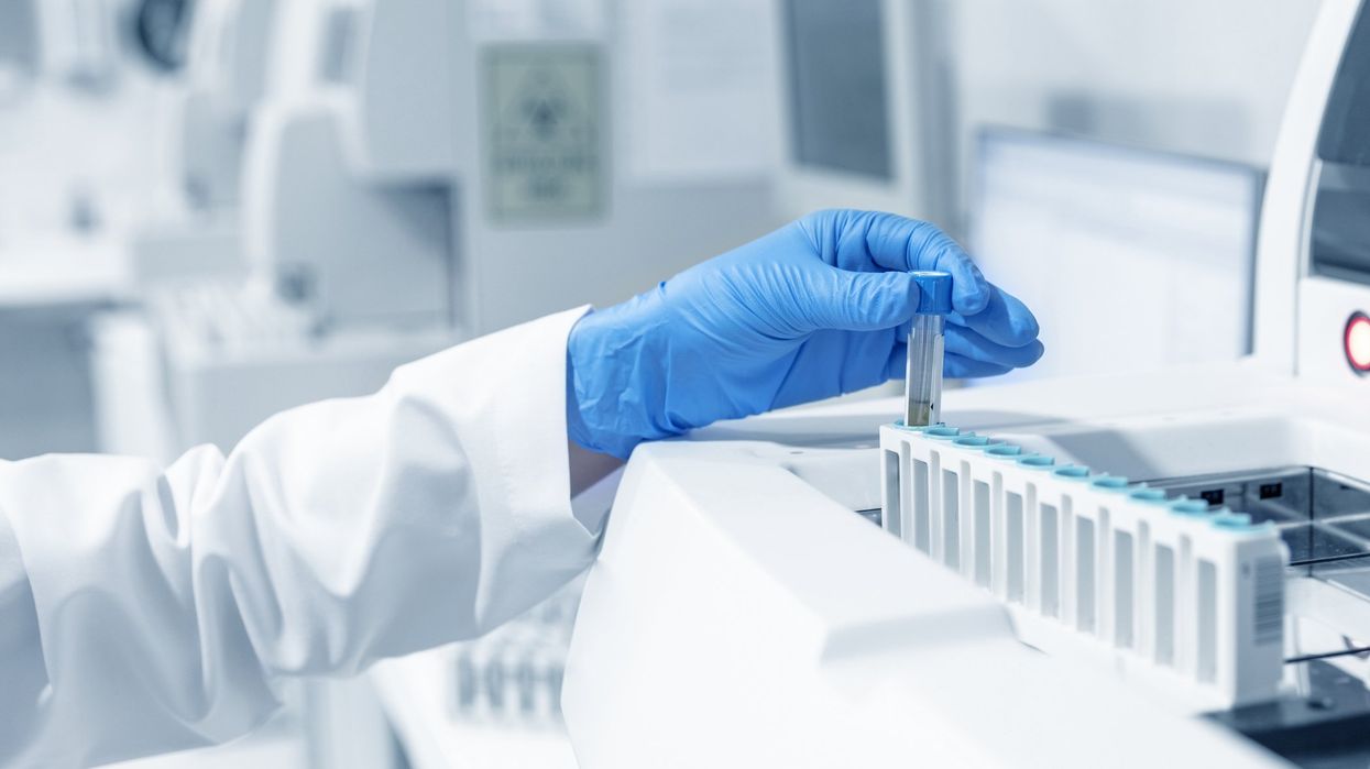 A scientist analyzes a virus sample in a laboratory.