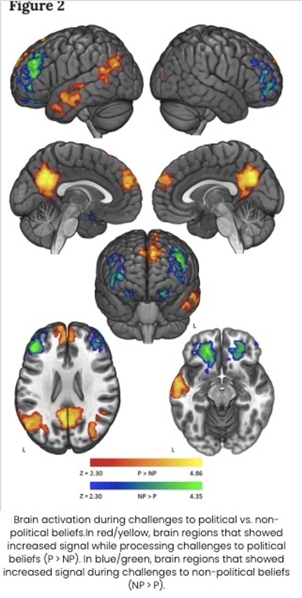 Brain activation during challenges to political vs non-political beliefs (figure)