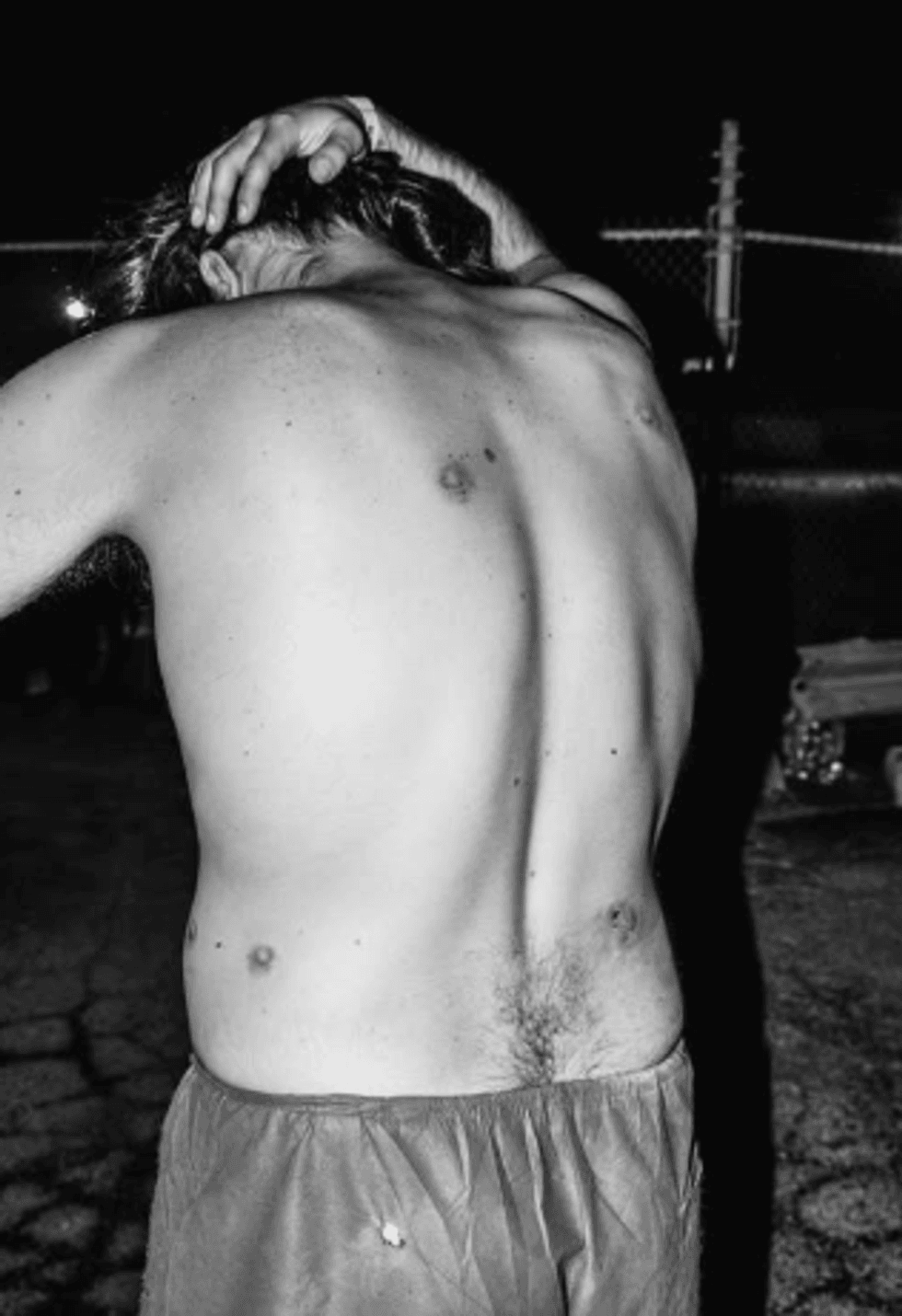 bullet wounds on bryan's back