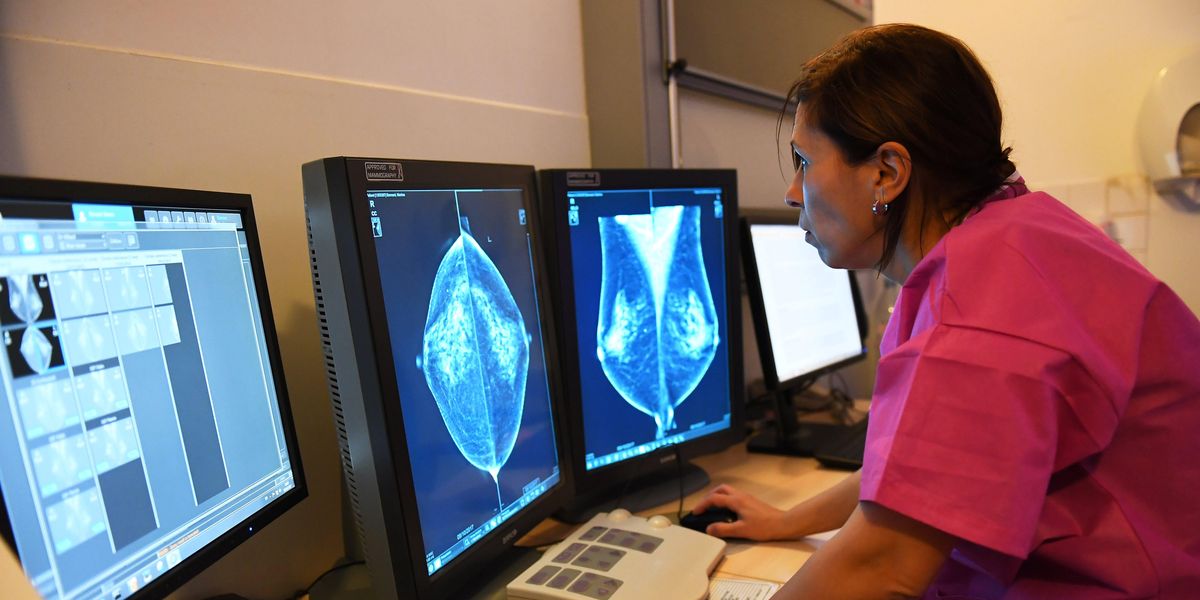 Researcher looks at mammography test