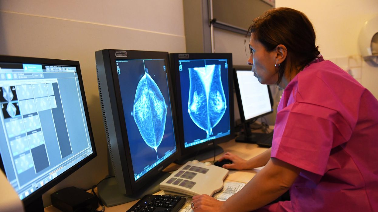 Researcher looks at mammography test